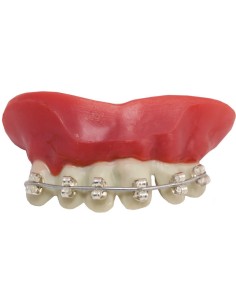 Denti Storiti Con...